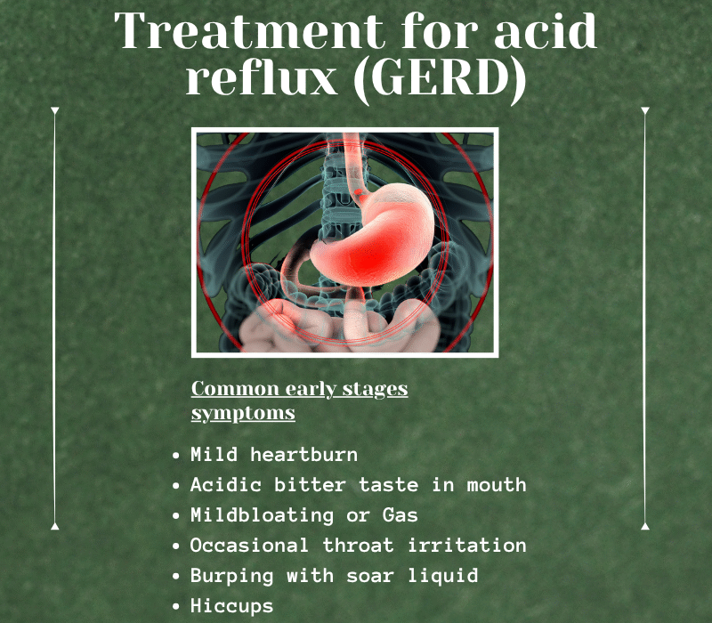 Treatment for acid reflux (GERD)