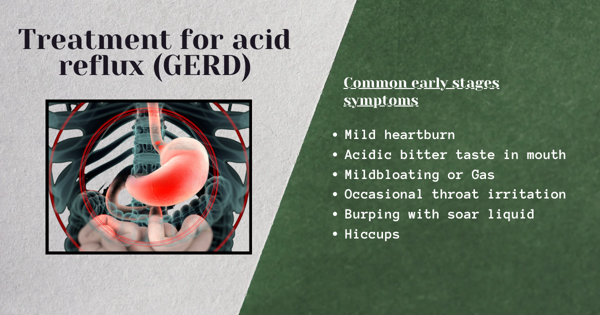 Treatment for acid reflux (GERD) with Common early stages symptoms.
